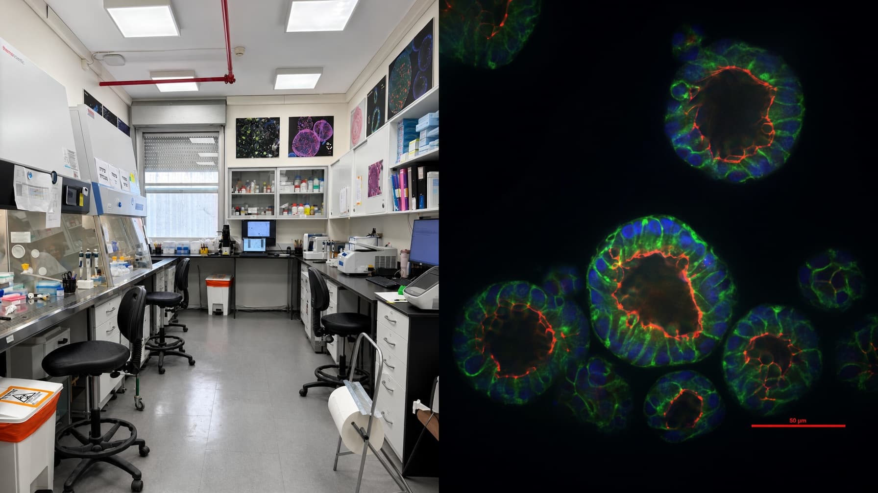 Laboratory at Hadassah alongside an immunofluorescence image of colon organoids.